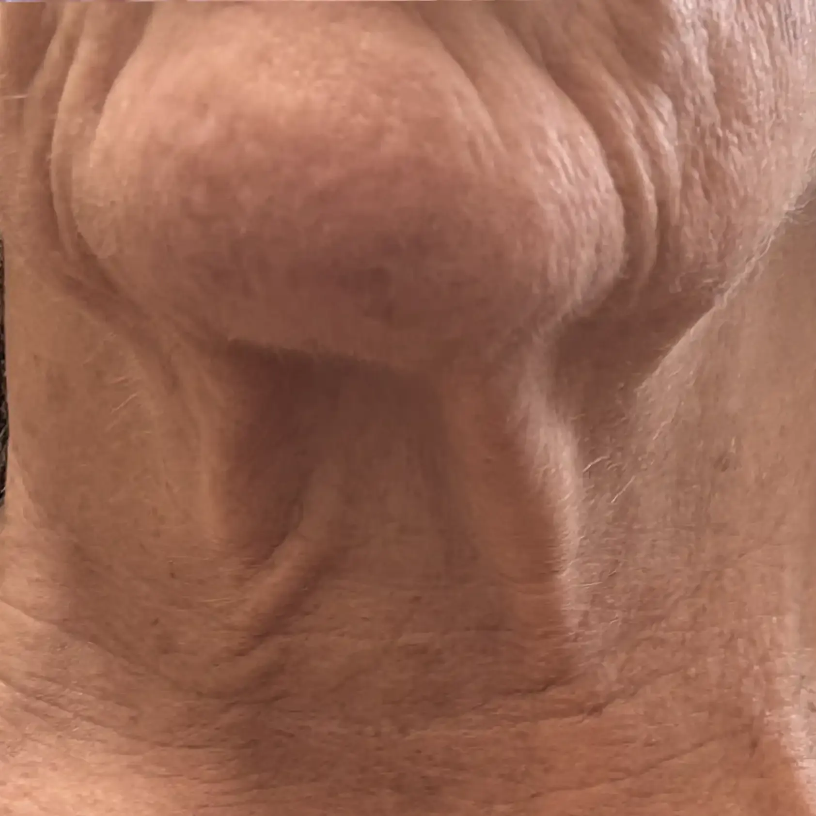 poslije tretmana koža